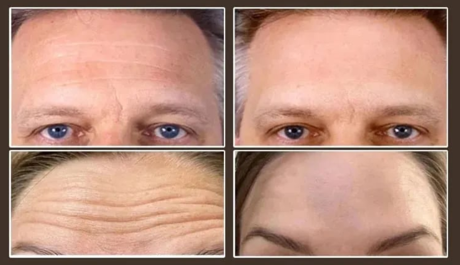 Un Toque Para Eliminar Las Arrugas🔥Loción Antiarrugas con Colágeno Micromolecular