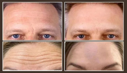 Un Toque Para Eliminar Las Arrugas🔥Loción Antiarrugas con Colágeno Micromolecular