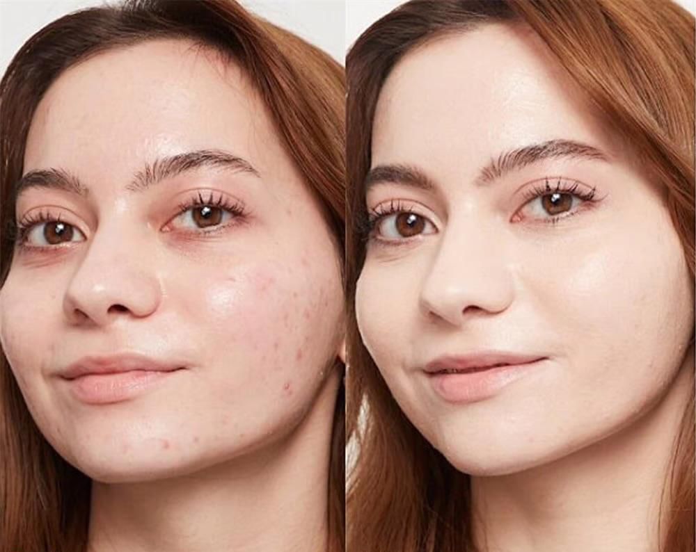 COMPRA 1 Y LLÉVATE 1 GRATIS 💥⏰💕🌟Barra de crema V Barra de Maquillaje Coreana Blanca que Cambia de Color con Volufiline